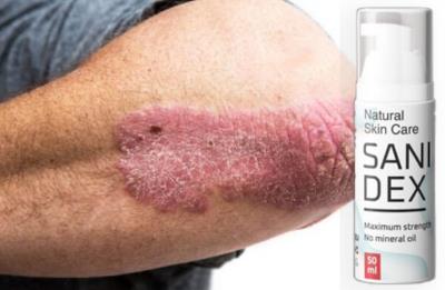 Sanidex se brzo rješava psorijaze, gdje kupiti, učinci, Hrvatska