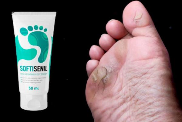 Softisenil je inovativna krema-gel, posebno stvorena za liječenje gljivičnih infekcija kože, uključujući i one koje se nalaze na stopalima, način primjene, gdje kupiti, Hrvatska.