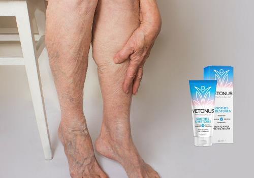 Vetonus gel za proširene vene, način primjene, gdje kupiti, Hrvatska