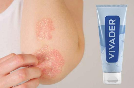 Vivader krema za psorijazu posebno je formulirana za ublažavanje iritacije, smanjenje upale i hidrataciju kože zahvaćene ovim kroničnim stanjem, način primjene, gdje kupiti, Hrvatska.